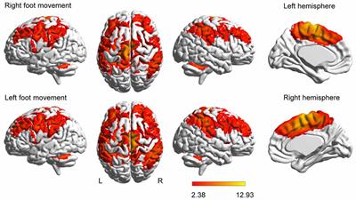 Strong Functional Connectivity among Homotopic Brain Areas Is Vital for Motor Control in Unilateral Limb Movement